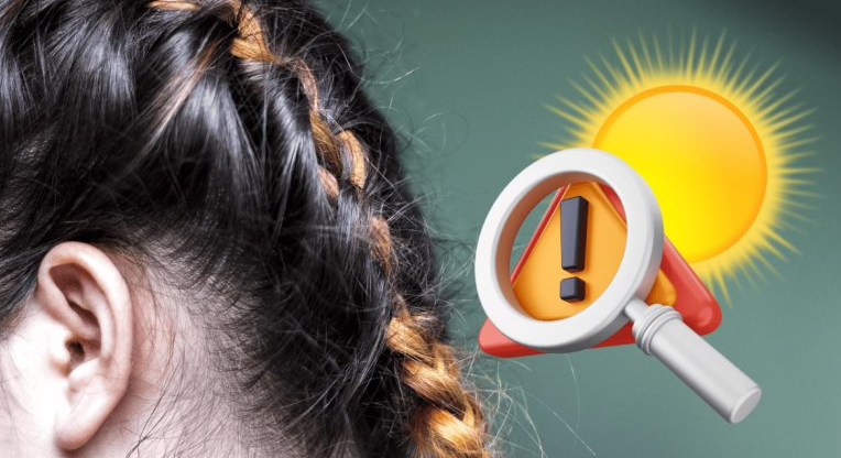 quemadura por trenzas